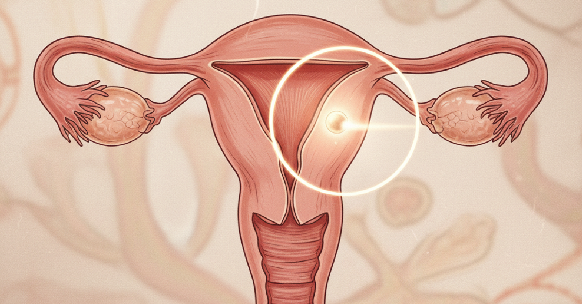 Ilustração do artigo